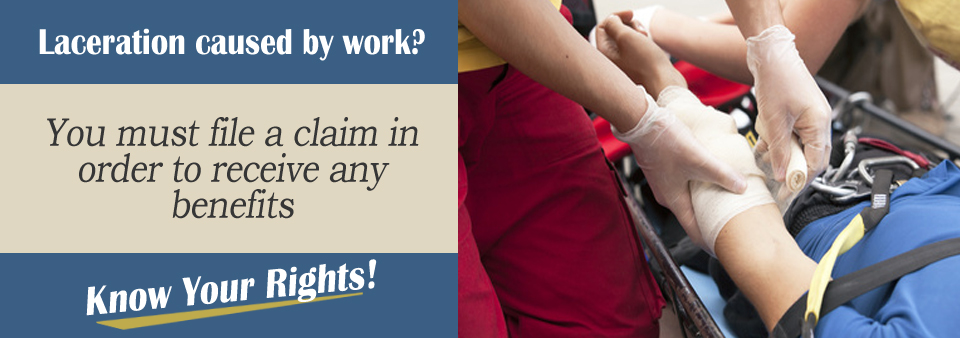 I Got Lacerations and Cuts While Working, Can I File a Claim?